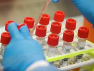 В городе Байконур зафиксировали первую смерть от коронавируса