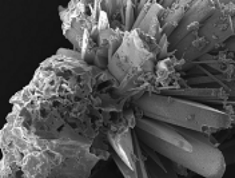 Кости из будущего: на МКС вырастили искусственный фрагмент скелета