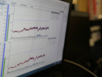 На МКС стартовал эксперимент по изучению микроциркуляции крови в условиях невесомости